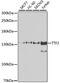 Transcription Termination Factor 2 antibody, GTX55824, GeneTex, Western Blot image 