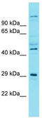 Siah E3 Ubiquitin Protein Ligase Family Member 3 antibody, TA334840, Origene, Western Blot image 