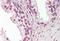 Protein Inhibitor Of Activated STAT 2 antibody, MBS242346, MyBioSource, Immunohistochemistry paraffin image 