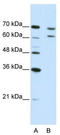 Cleavage and polyadenylation specificity factor subunit 3 antibody, TA343844, Origene, Western Blot image 