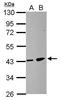 Zinc Finger DHHC-Type Containing 11 antibody, GTX106800, GeneTex, Western Blot image 