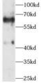 Wnt Family Member 3 antibody, FNab09518, FineTest, Western Blot image 