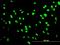 Autoantigen NOR-90 antibody, H00007343-M04, Novus Biologicals, Immunofluorescence image 
