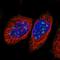 Nucleolar Protein 11 antibody, HPA022010, Atlas Antibodies, Immunofluorescence image 