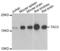 Tachykinin 3 antibody, abx004825, Abbexa, Western Blot image 
