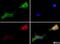 Transient Receptor Potential Cation Channel Subfamily V Member 1 antibody, NBP1-97417, Novus Biologicals, Immunofluorescence image 