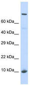 Putative NOL1/NOP2/Sun domain family member 5B antibody, TA340410, Origene, Western Blot image 