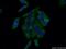 Golgi Membrane Protein 1 antibody, 66331-1-Ig, Proteintech Group, Immunofluorescence image 