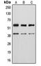 Vimentin antibody, LS-C353032, Lifespan Biosciences, Western Blot image 