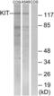 c-Kit antibody, LS-C118170, Lifespan Biosciences, Western Blot image 
