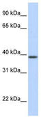 Solute Carrier Family 25 Member 42 antibody, TA334622, Origene, Western Blot image 