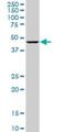 Olfactomedin 3 antibody, H00118427-M06, Novus Biologicals, Western Blot image 