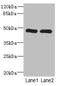 Homogentisate 1,2-Dioxygenase antibody, LS-C675862, Lifespan Biosciences, Western Blot image 