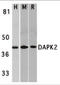 Death Associated Protein Kinase 2 antibody, 2323, ProSci Inc, Western Blot image 