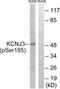 Potassium Voltage-Gated Channel Subfamily J Member 3 antibody, LS-C199000, Lifespan Biosciences, Western Blot image 