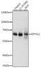 Dihydropyrimidinase Like 2 antibody, GTX35221, GeneTex, Western Blot image 