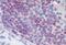 X-C Motif Chemokine Receptor 1 antibody, NBP1-02343, Novus Biologicals, Immunohistochemistry frozen image 