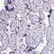 Napsin A Aspartic Peptidase antibody, HPA045280, Atlas Antibodies, Immunohistochemistry frozen image 
