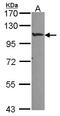 HIF-2-alpha antibody, LS-B4223, Lifespan Biosciences, Western Blot image 