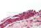 Cell surface glycoprotein MUC18 antibody, ARP63483_P050, Aviva Systems Biology, Immunohistochemistry paraffin image 