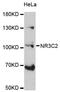 Nuclear Receptor Subfamily 3 Group C Member 2 antibody, MBS128888, MyBioSource, Western Blot image 