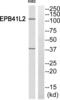 Erythrocyte Membrane Protein Band 4.1 Like 2 antibody, abx014248, Abbexa, Western Blot image 