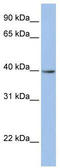 Zinc Finger Protein 202 antibody, TA333998, Origene, Western Blot image 