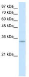 PACT antibody, TA345847, Origene, Western Blot image 