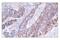 Cyclin D1 antibody, 55506T, Cell Signaling Technology, Immunohistochemistry paraffin image 
