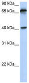 MHC Class I Polypeptide-Related Sequence A antibody, TA334663, Origene, Western Blot image 