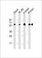 Protein Kinase C And Casein Kinase Substrate In Neurons 2 antibody, M04211, Boster Biological Technology, Western Blot image 