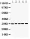 Gamma-secretase subunit APH-1A antibody, PB9421, Boster Biological Technology, Western Blot image 