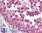 HAVcr-1 antibody, LS-B2031, Lifespan Biosciences, Immunohistochemistry frozen image 