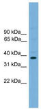 ATF4 antibody, TA341834, Origene, Western Blot image 