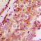 Junction Mediating And Regulatory Protein, P53 Cofactor antibody, LS-C356137, Lifespan Biosciences, Immunohistochemistry paraffin image 
