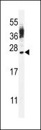 Cancer/testis antigen family 45 member A4/A6 antibody, MBS9203564, MyBioSource, Western Blot image 