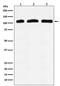 Phosphatidylinositol-4,5-bisphosphate 3-kinase catalytic subunit delta isoform antibody, M02269, Boster Biological Technology, Western Blot image 