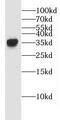 Enoyl-CoA Hydratase 1 antibody, FNab02622, FineTest, Western Blot image 