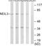 Nei Like DNA Glycosylase 3 antibody, LS-B13433, Lifespan Biosciences, Western Blot image 
