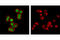 p53 antibody, 5429S, Cell Signaling Technology, Immunocytochemistry image 