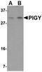 Phosphatidylinositol Glycan Anchor Biosynthesis Class Y antibody, orb75115, Biorbyt, Western Blot image 