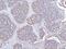 Pleckstrin antibody, A06656-3, Boster Biological Technology, Immunohistochemistry paraffin image 