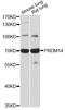 PR/SET Domain 14 antibody, A13658, ABclonal Technology, Western Blot image 