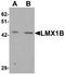LIM Homeobox Transcription Factor 1 Beta antibody, A03296, Boster Biological Technology, Western Blot image 