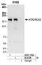 Ataxin 2 antibody, A301-118A, Bethyl Labs, Immunoprecipitation image 