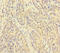 Pappalysin-1 antibody, LS-C285667, Lifespan Biosciences, Immunohistochemistry paraffin image 