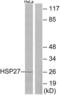 Heat Shock Protein Family B (Small) Member 1 antibody, LS-B6642, Lifespan Biosciences, Western Blot image 
