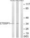 SCP1 antibody, A30598, Boster Biological Technology, Western Blot image 