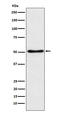 Secreted frizzled-related protein 4 antibody, M03147-1, Boster Biological Technology, Western Blot image 