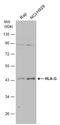 Major Histocompatibility Complex, Class I, G antibody, GTX112713, GeneTex, Western Blot image 